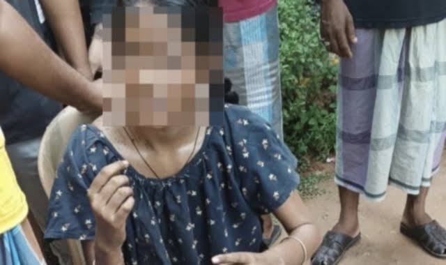 ଦିଲ୍ଲୀ ଏମ୍ସରେ ବଳଙ୍ଗା ପୀଡ଼ିତାଙ୍କ ହେଲା ସ୍କିନ୍ ଟ୍ରାନ୍ସପ୍ଲାଣ୍ଟ, ସ୍ୱାସ୍ଥ୍ୟବସ୍ଥା ସ୍ଥିର ଥିବା ନେଇ ସୂଚନା