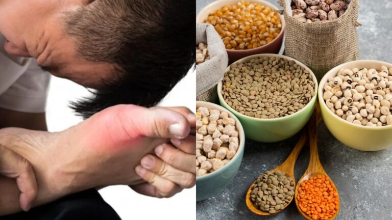 ଆସନ୍ତୁ ଜାଣିବା କେଉଁ ଡାଲି ଖାଇଲେ ପାଖ ମାଡ଼ିବନି ୟୁରିକ ଏସିଡ