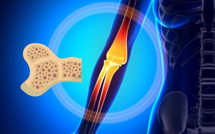 ହାଡ଼କୁ ଦୁର୍ବଳ କରେ ଏହି ୫ ଟି ଜିନିଷ, ଏହି ସବୁଠାରୁ ଦୂରରେ ରୁହନ୍ତୁ