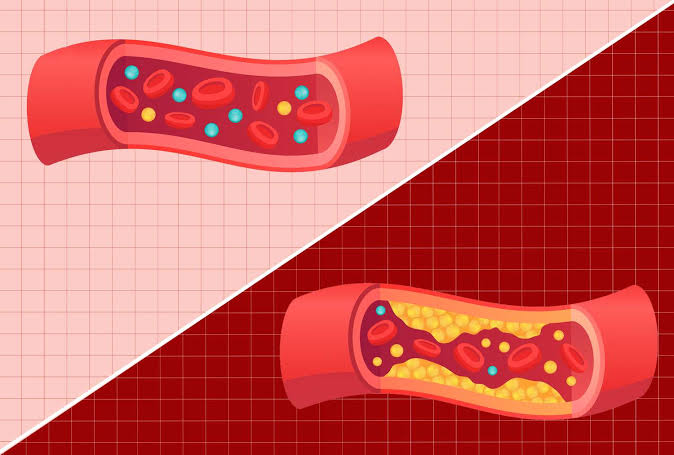 ଭଲ ଓ ଖରାପ କୋଲେଷ୍ଟ୍ରଲ୍‌ ଭିତରେ କ’ଣ ରହିଛି ପାର୍ଥକ୍ୟ? LDL ଓ HDL ବିଷୟରେ ଜାଣନ୍ତୁ